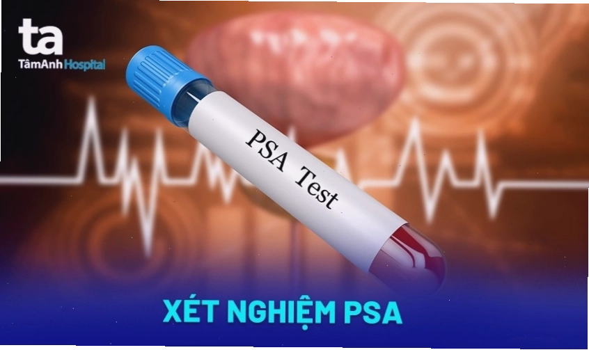 Bác sĩ thực hiện khám lâm sàng tuyến vú cho bệnh nhân