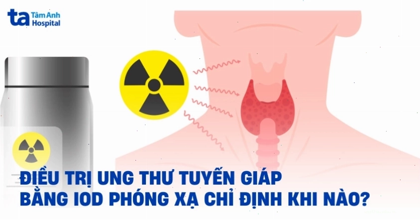 Bệnh nhân chụp xạ hình sau điều trị ung thư tuyến giáp bằng iod 131 có di căn phổi