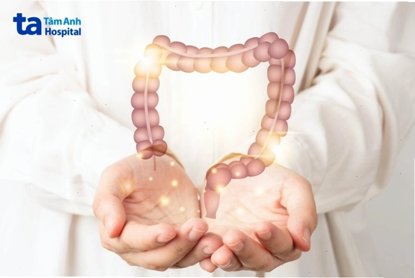 Bệnh ung thư trực tràng cần được phát hiện sớm để tăng hiệu quả điều trị