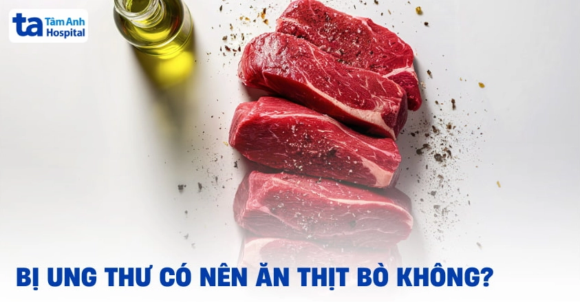 Bị ung thư có nên ăn thịt bò không và những điều cần biết