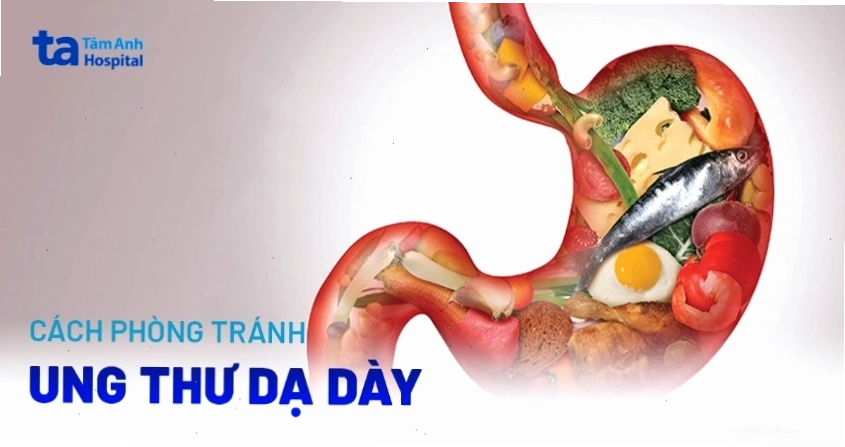 Biện pháp phòng tránh ung thư dạ dày hiệu quả và dễ thực hiện