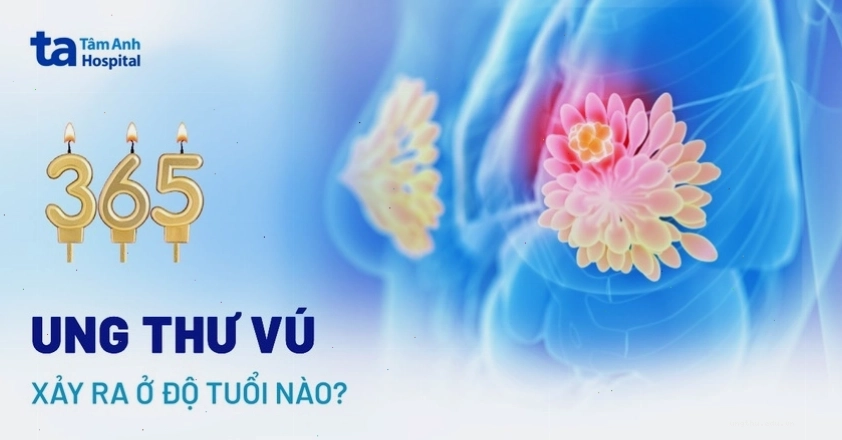 Biểu đồ thể hiện độ tuổi mắc ung thư vú ở nữ giới và nam giới