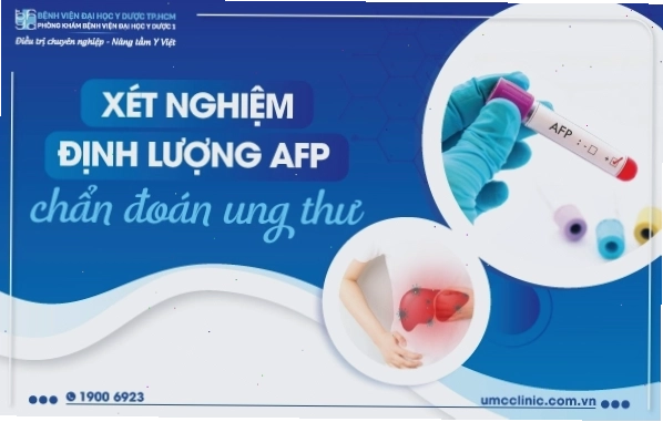 Biểu đồ thể hiện nồng độ AFP tăng cao trong bệnh lý ung thư gan