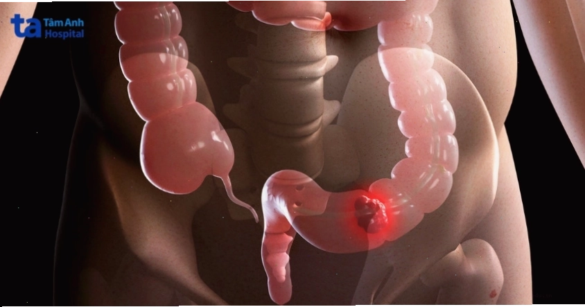 Các phương pháp điều trị có thể gây ra tác dụng phụ