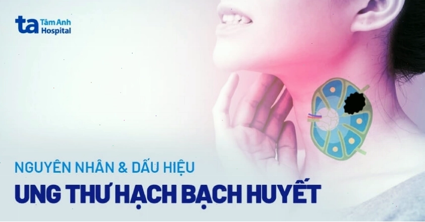 Cấu trúc hạch bạch huyết và tế bào lympho trong cơ thể người