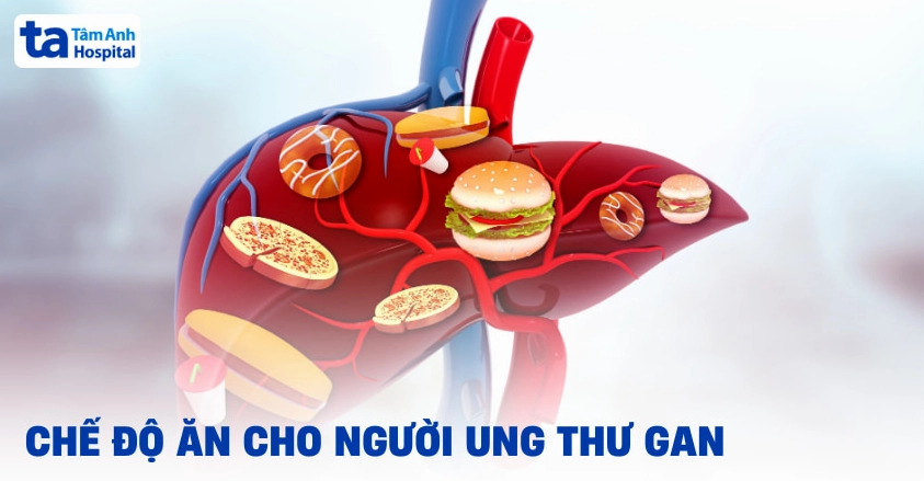 Chế độ ăn cho bệnh nhân ung thư gan: Lựa chọn thực phẩm và nguyên tắc dinh dưỡng