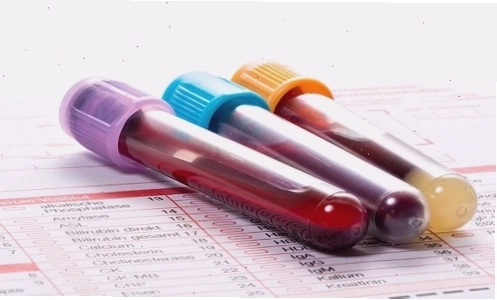 Chỉ số Alpha-fetoprotein (AFP) trong xét nghiệm marker ung thư gan