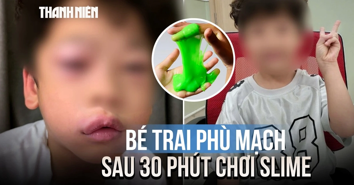 Chơi Slime có thực sự gây ung thư? Phân tích chuyên sâu và lời khuyên
