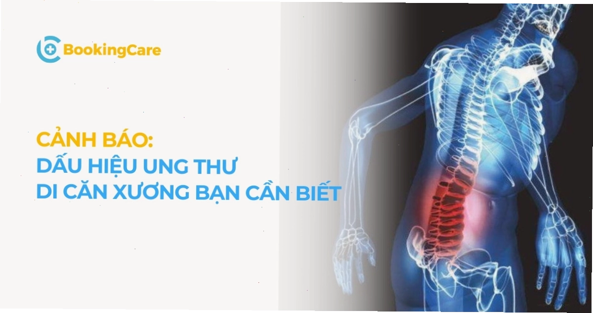 Dấu hiệu ung thư di căn xương cần biết để phát hiện sớm