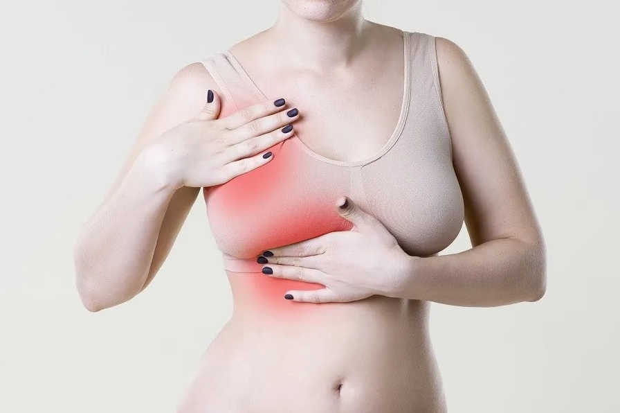 Dấu hiệu ung thư vú giai đoạn cuối và hành trình kiểm soát bệnh