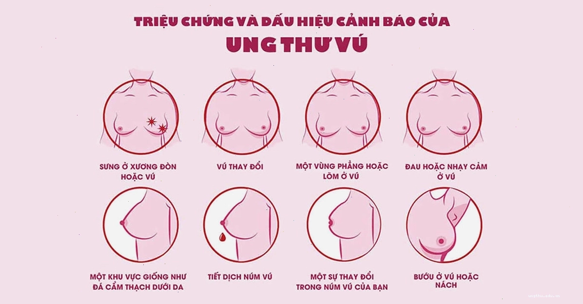 Dấu hiệu ung thư vú và các biến chứng
