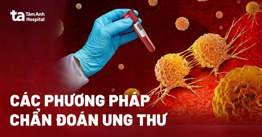 Giấy Chẩn Đoán Ung Thư: Hiểu Đúng, Tránh Lầm Lầm Tưởng