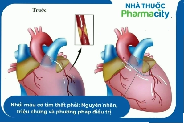 Hình ảnh cận cảnh tế bào tủy xương dưới kính hiển vi