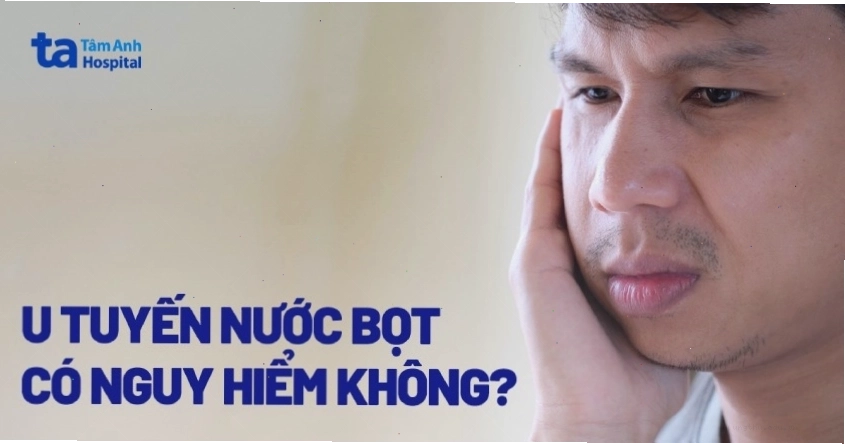 Hình ảnh minh họa các tuyến nước bọt chính trên khuôn mặt