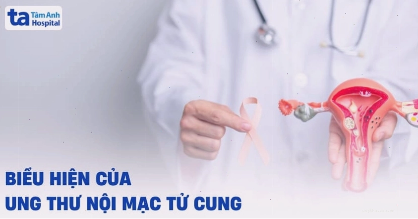 Hình ảnh minh họa cấu trúc tế bào ung thư nội mạc tử cung