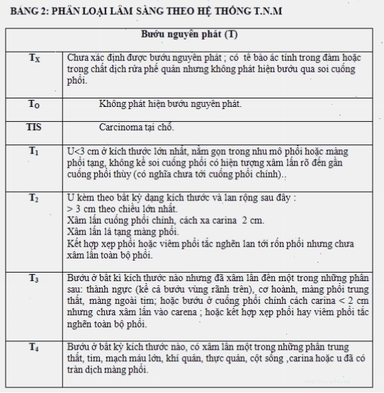 Hình ảnh minh họa người bệnh ho khan kéo dài