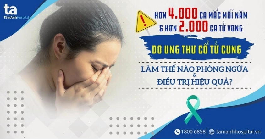 Hình ảnh minh họa ung thư cổ tử cung và cấu trúc tế bào