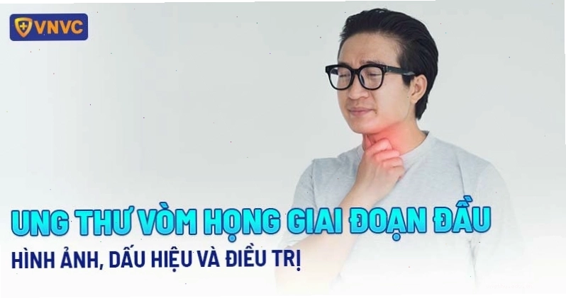 Hình ảnh ung thư vòm họng giai đoạn đầu