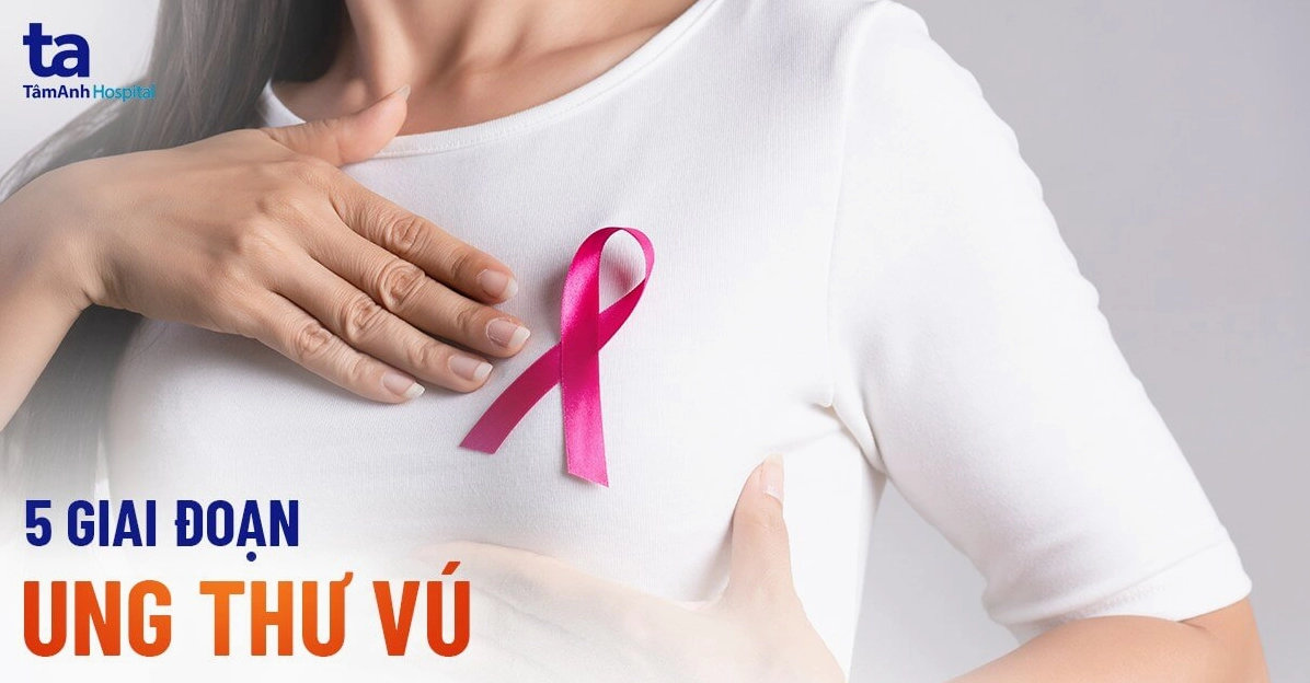 Hình ảnh ung thư vú giai đoạn cuối và những dấu hiệu cảnh báo