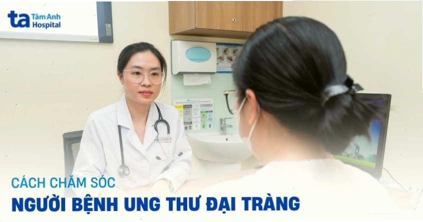 Minh họa cấu trúc đại tràng và vị trí khối u ung thư