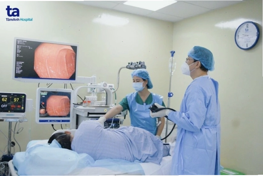 Nội soi chẩn đoán ung thư đại tràng giai đoạn 0