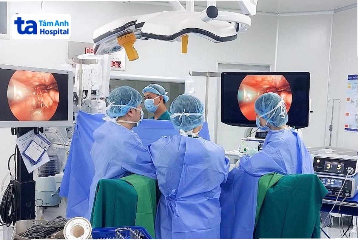 Nội soi là một trong những kỹ thuật được sử dụng để loại bỏ khối u tuyến ức