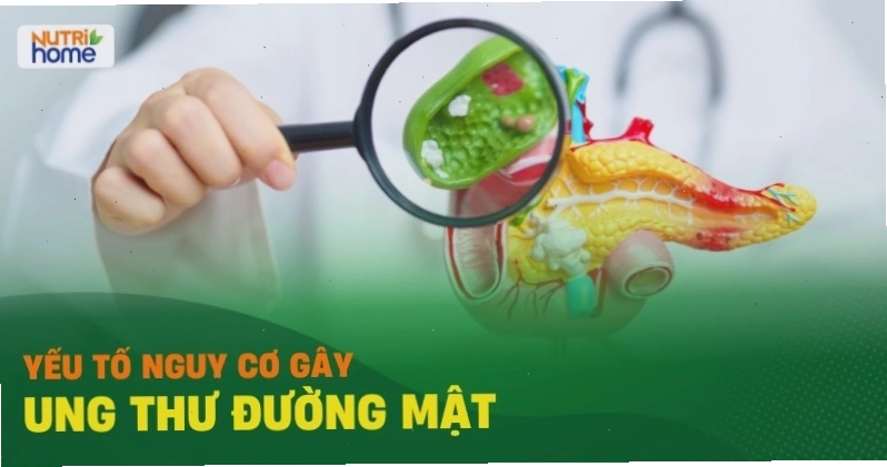 Phác đồ điều trị ung thư túi mật với sự kết hợp đa phương pháp.