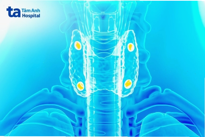 Phẫu thuật điều trị u tuyến cận giáp