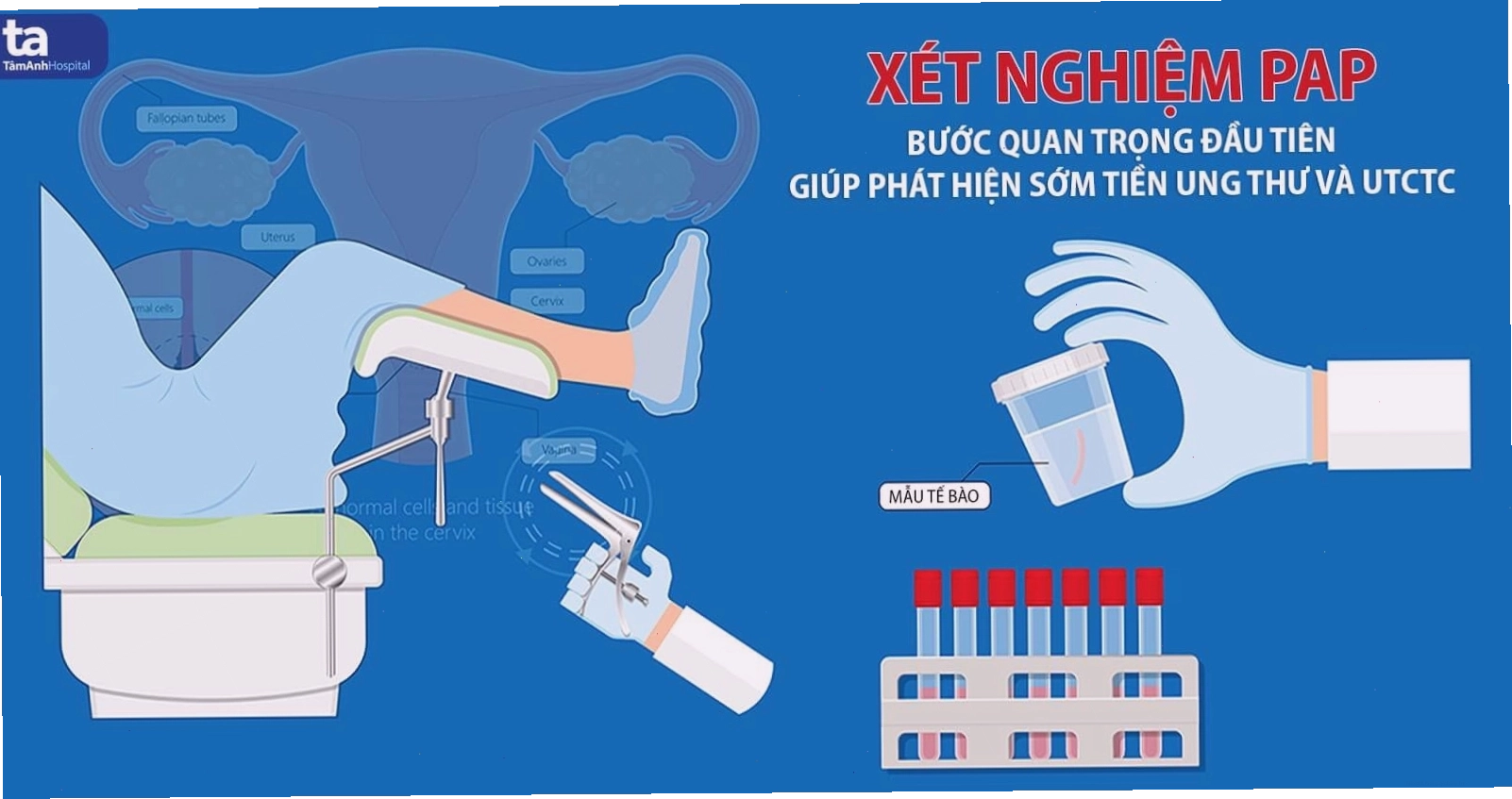 Phụ nữ đang thực hiện chụp nhũ ảnh