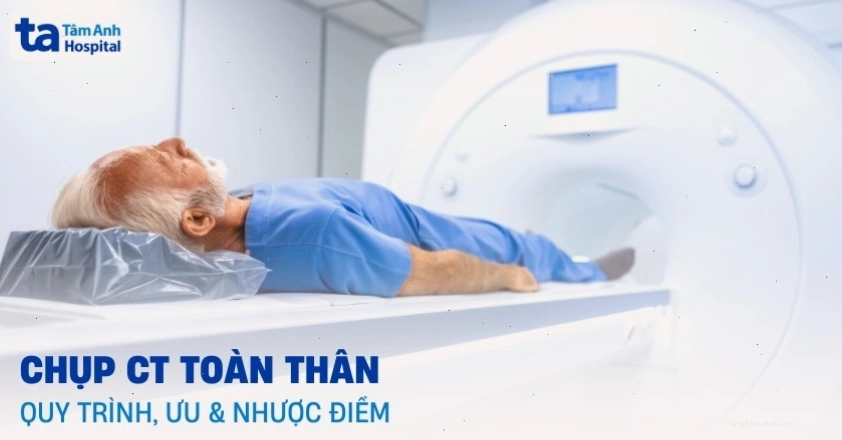 Quy trình chụp CT toàn thân tại bệnh viện