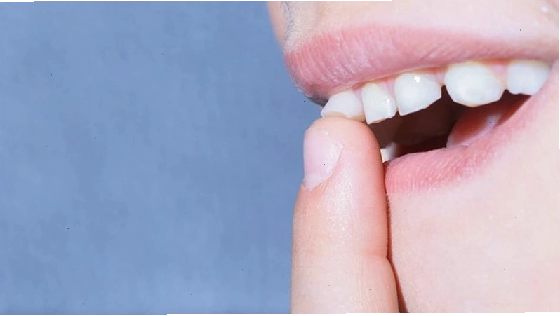Răng lung lay có thể là biểu hiện của vấn đề về nướu