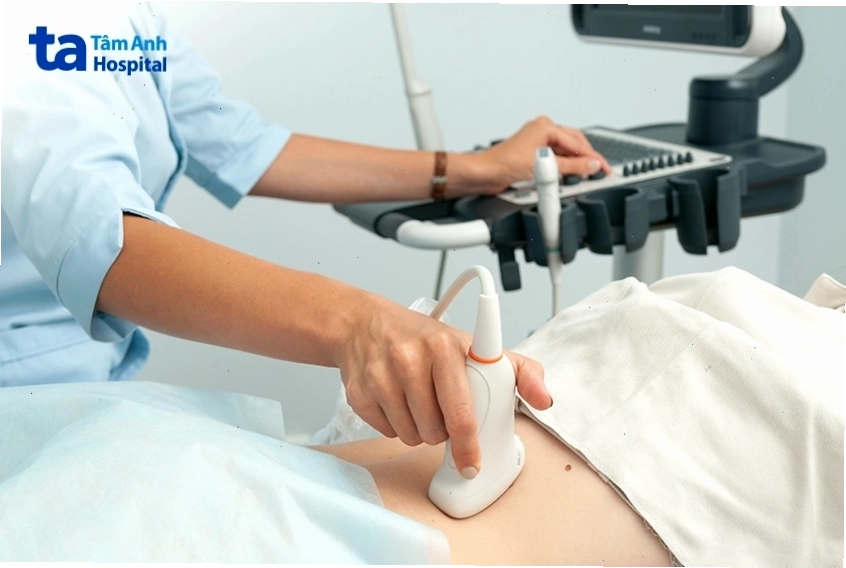 Siêu âm có thể giúp phát hiện gián tiếp ung thư dạ dày