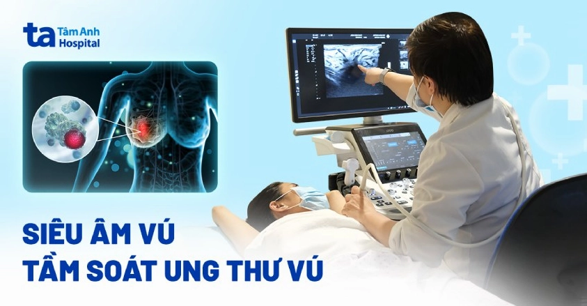 Siêu âm vú có phát hiện ung thư không? Thông tin chi tiết 2026