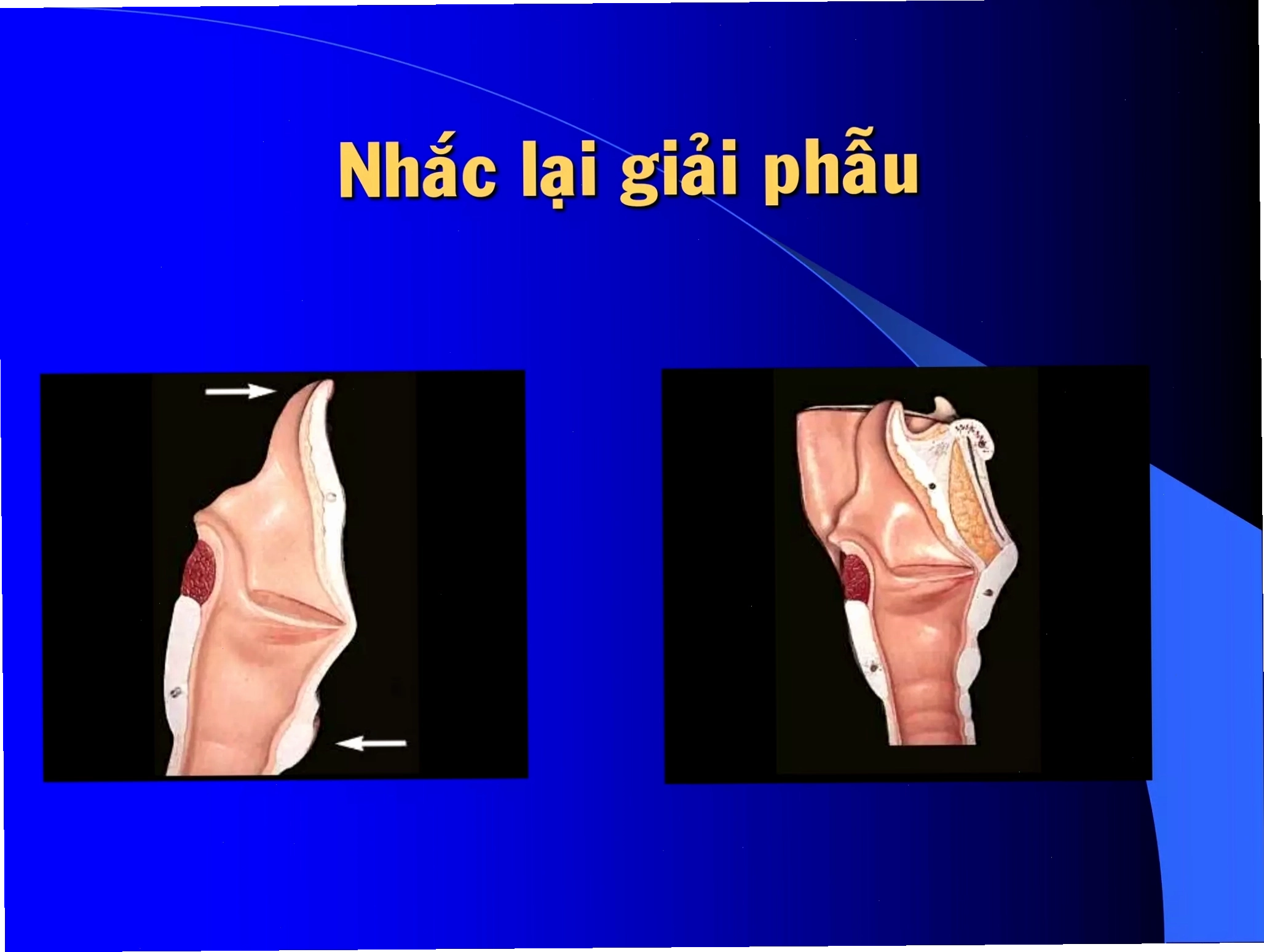 Sơ đồ phân loại TNM cho ung thư thanh quản