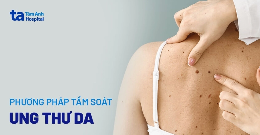 Tầm soát ung thư da tại Hà Nội: Địa chỉ uy tín và quy trình chuẩn