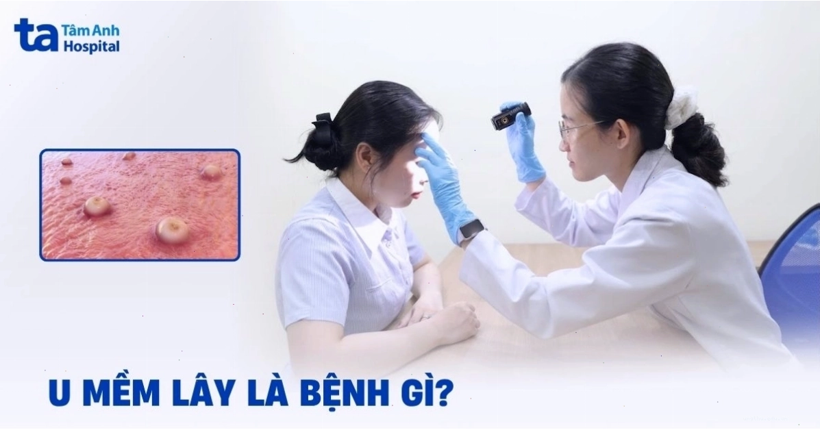 Tập luyện thể dục thể thao đều đặn giúp phòng ngừa ung thư