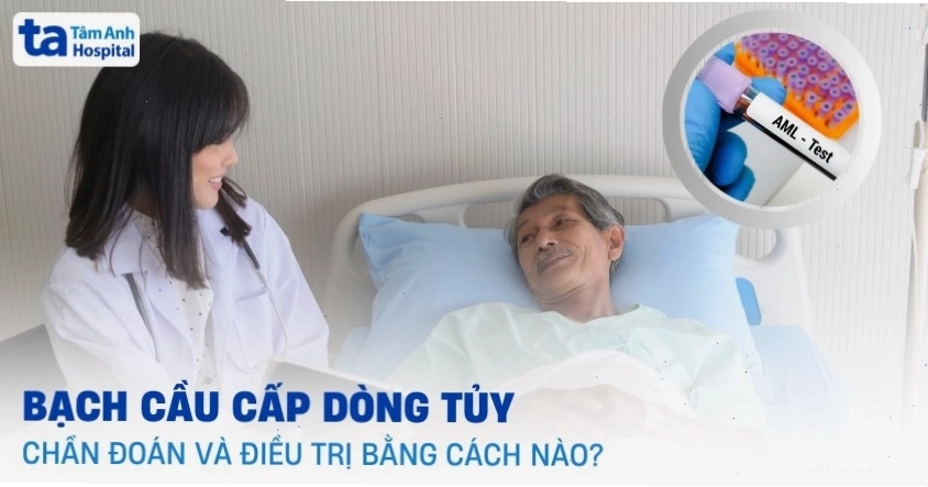 Tế bào máu bất thường trong tủy xương là đặc điểm của bạch cầu cấp dòng tủy