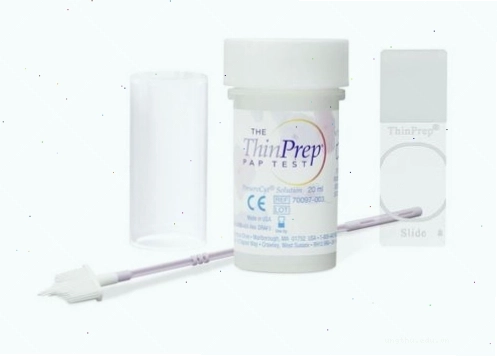 ThinPrep Pap Test - Phương pháp mới xét nghiệm sớm ung thư cổ tử cung