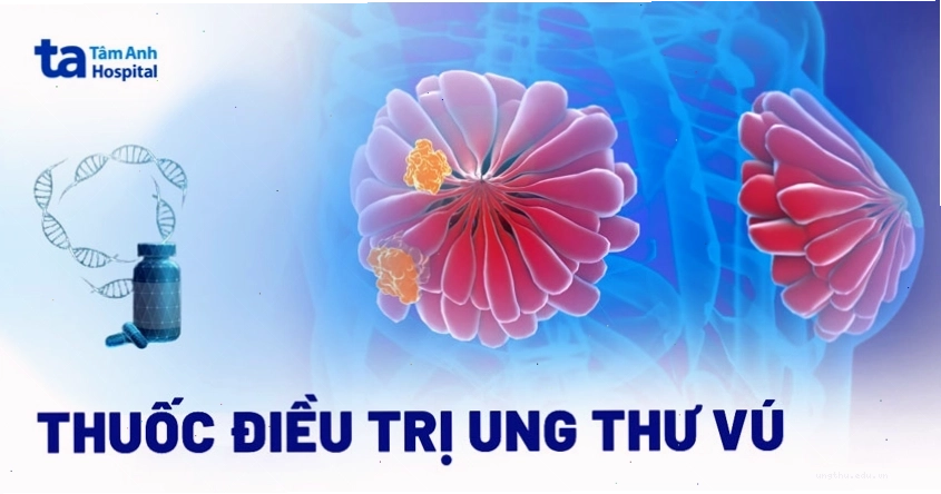 Thuốc điều trị ung thư vú, một lựa chọn quan trọng trong y học hiện đại