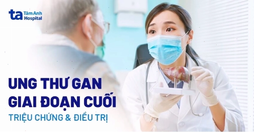 Triệu chứng ung thư gan giai đoạn cuối: Vàng da và báng bụng