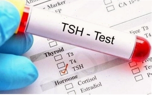 TSH được xem là chỉ số xét nghiệm ung thư tuyến giáp cần được xem xét đầu tiên.