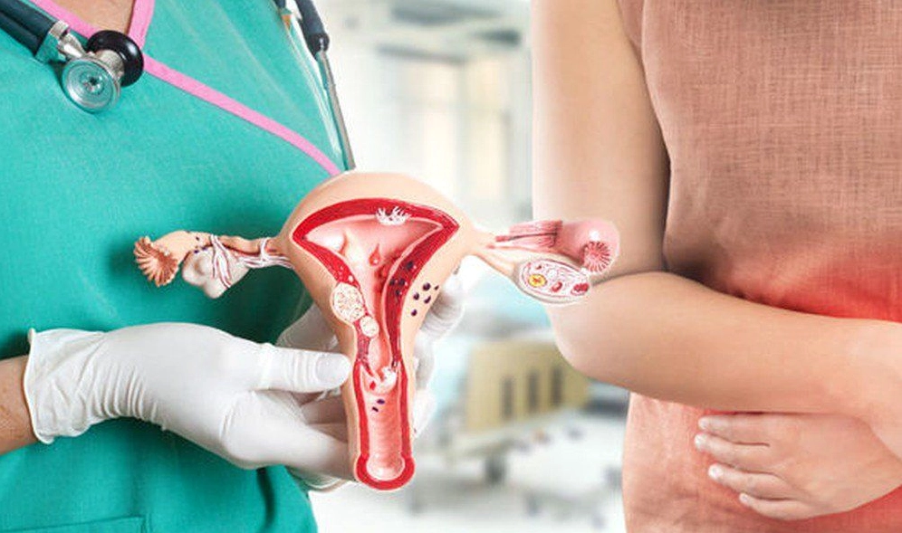 Ung thư cổ tử cung có chữa được không? Khả năng sống sót và các phương pháp điều trị