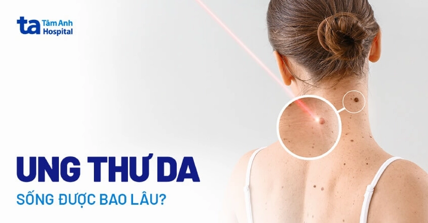 Ung thư da có chết không và các yếu tố ảnh hưởng đến tiên lượng
