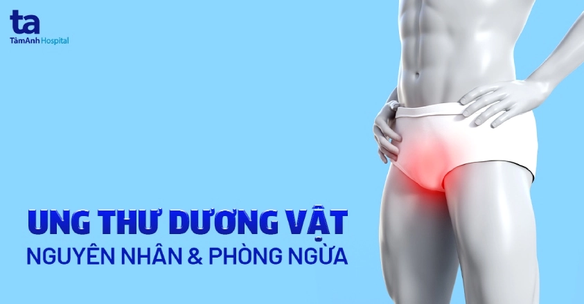 Ung thư dương vật: Nguyên nhân, dấu hiệu, chẩn đoán và cách phòng ngừa