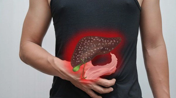 Ung thư gan có dịch trong ổ bụng: Nguyên nhân, Chẩn đoán và Phương pháp Điều trị