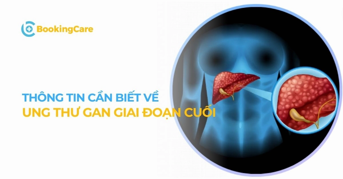 Ung thư gan giai đoạn cuối: Hy vọng nào cho người bệnh?