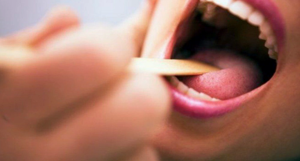 Ung Thư Hốc Miệng: Dấu Hiệu Sớm, Nguyên Nhân Và Cách Phòng Ngừa Hiệu Quả