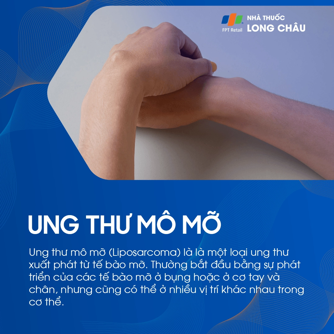 Ung thư mỡ những điều cần biết về nguyên nhân, triệu chứng và cách điều trị