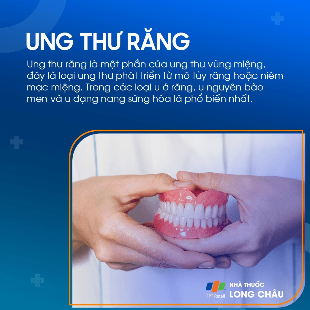 Ung thư răng có chết không? Giải đáp chi tiết và cách phòng ngừa