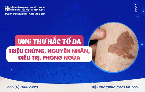 Ung thư sắc tố có chết không: Hiểu rõ tiên lượng và các yếu tố ảnh hưởng